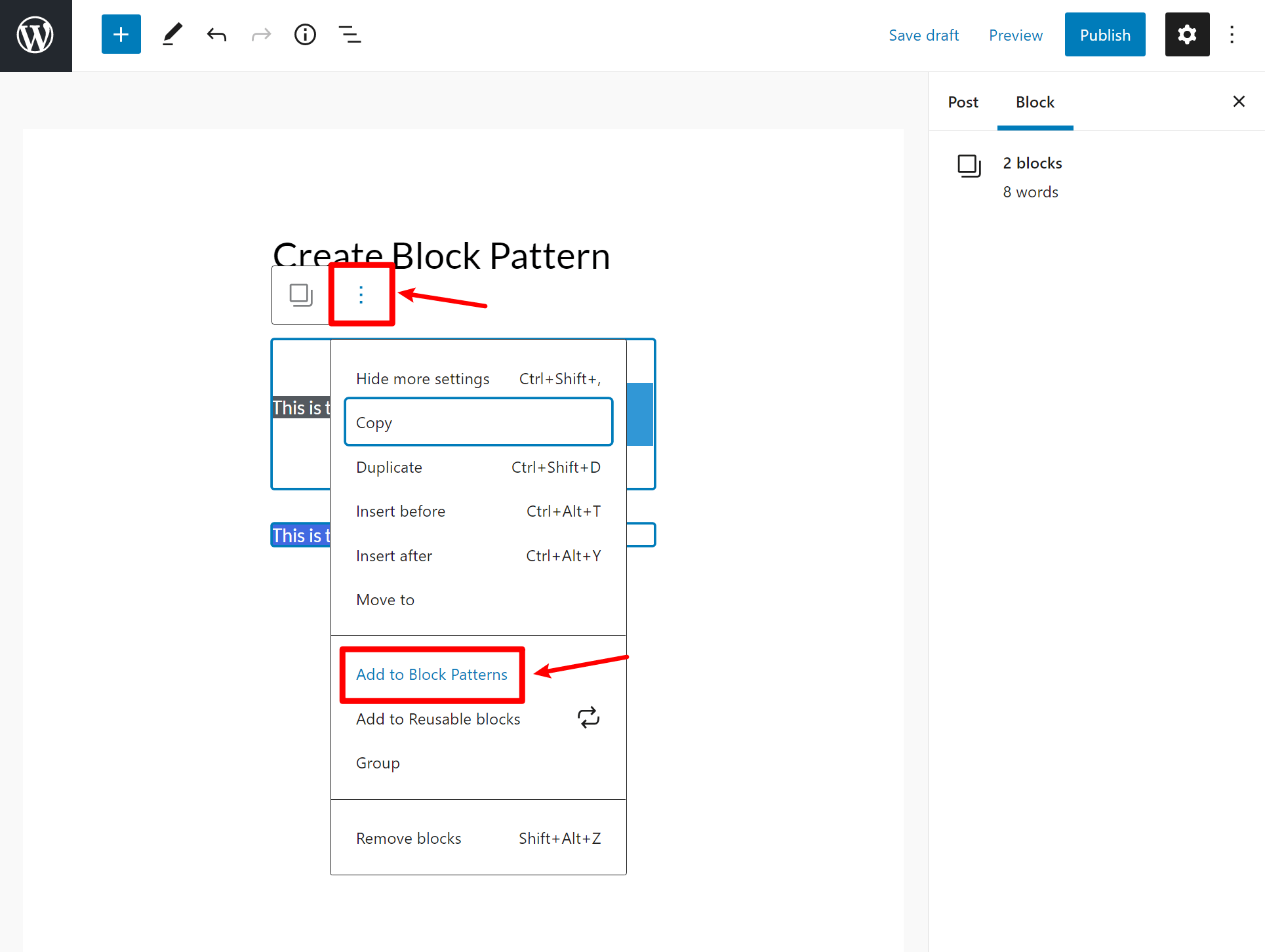 Créer un nouveau modèle de bloc